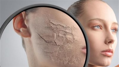 في الحر.. المكياج يسبب أضرار خطيرة 