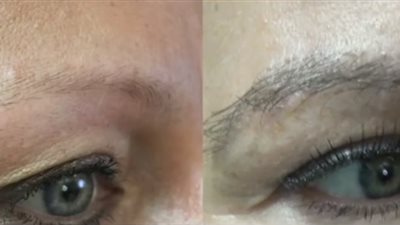 7 أسباب وراء فقدان شعر الحواجب.. تعرفي عليها 