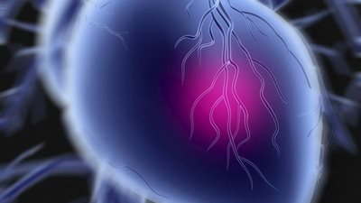 أمراض القلب تودي بحياة 155 ألف بريطاني سنويًا