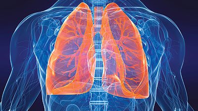 الالتهاب الرئوى الانسدادى المزمن يحتل المرتبة الرابعة وراء وفيات المدخنين فى فرنسا