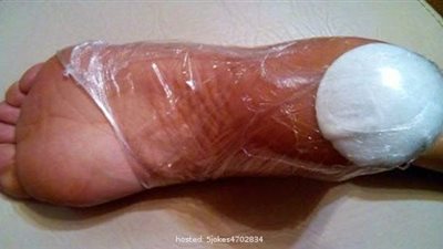 بالقطن والأسبرين.. كيف تعالج تشققات القدمين بشكل نهائي؟