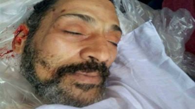 بالمستندات.. دفاع مجدي مكين يتهم طبيبة مستشفى الزيتون بتزوير التقرير الطبي