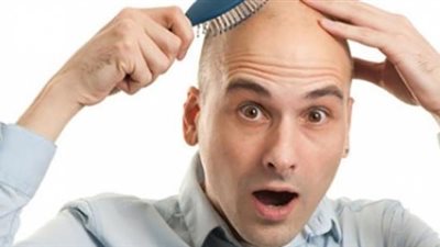 منها التدخين وعدد الأبناء.. 5 عوامل تنذر بـ«الصلع المبكر» 