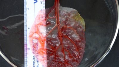 العلماء ينجحون أخيرًا في زراعة قلب بشري.. بطريقة لن تتصورها!