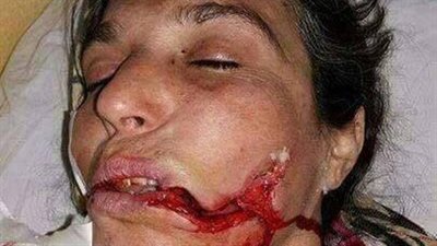 بالصور.. «جزار المنوفية» يهشّم وجه «بائعة الأنابيب».. والسبب صادم 