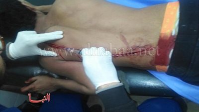 بالصور.. طالب ثانوي بحلوان يمزق جسد زميله 
