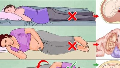 أفضل أوضاع النوم للحوامل 