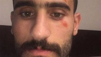 أول ظهور لـ«باسم مرسي» بعد حادث أكتوبر 