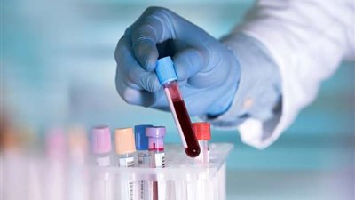 احترس من نوبات القلب.. إذا كنت صاحب تلك الفصيلة من الدم!