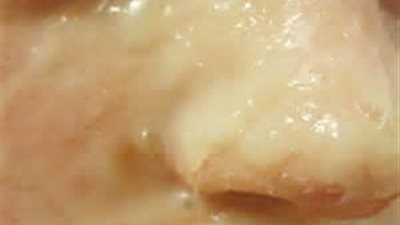 «الجيلاتين».. أسهل طريقة لـ«إزالة الشعر» من الجذور