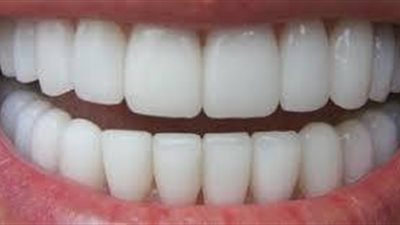 5 وصفات طبيعية لـ«تبييض أسنانك»