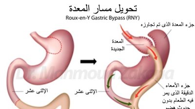 بالفيديو.. الحل النهائي لعلاج مرض السكر بدون أدوية
