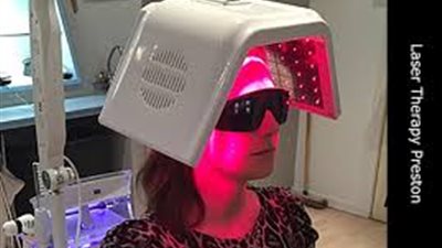 بعد تقنية الليزر البارد.. وداعًا لـ«عمليات زراعة الشعر» 