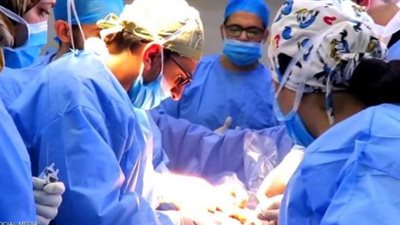 لأول مرة بمعهد الكلى: عملية ناجحة لاستئصال 