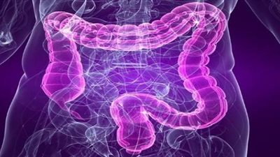 بالفيديو.. أطعمة مُفيدة لـ«القولون العصبي» وأخرى تضر به