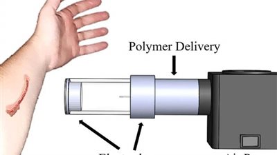 العلماء يتوصلون لضمادات ذكية تعالج الجروح بسرعة ودقة