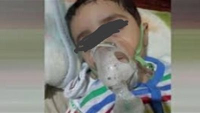 تناول أقراصا لعلاج القولون.. إصابة طفل بحالة تسمم في البحيرة