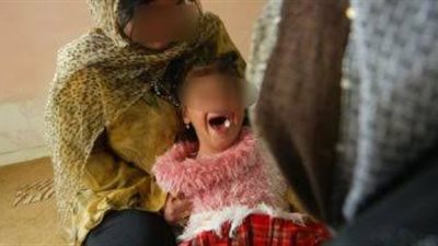  في يومه العالمي.. 200 مليون فتاة تعرضن للختان على مستوى العالم