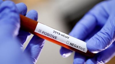 عاجل.. طبيب بـ«القصر العيني» يعلن معجزة طبية لعلاج «كورونا»