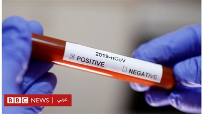 أمريكا تعلن نتائج أولى تجارب لقاح فيروس كورونا