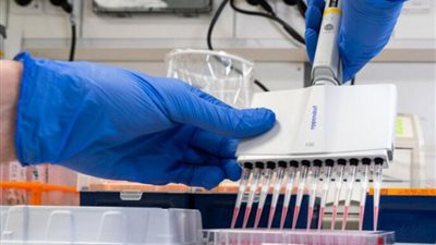 163 ألف جنيه فاتورة علاج من فيروس 