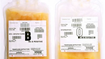 لا يحق للمعامل والمستشفيات الخاصة سحب بلازما المتعافين من كورونا