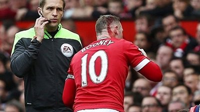 روني ينزف الدماء في ديربي مانشستر