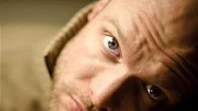 دواء جديد يبشر بعلاج الصلع في 10 أيام !