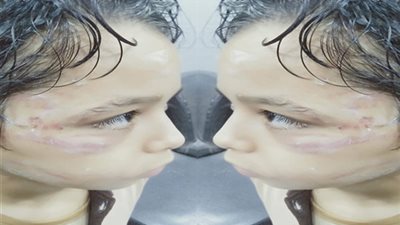 صور| أصابته بارتجاج في المخ.. تفاصيل 