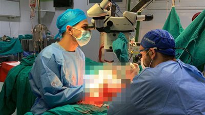 فريق طبى بجامعة أسيوط ينجح فى إجراء جراحة معقدة لتوصيل ذراع مبتورة لطالبة