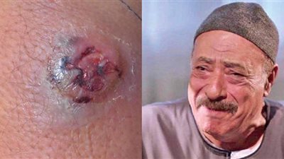 بعد وفاة فايق عزب بـ 