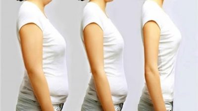 احذرها.. 8 أطعمة تتسبب في دهون البطن 