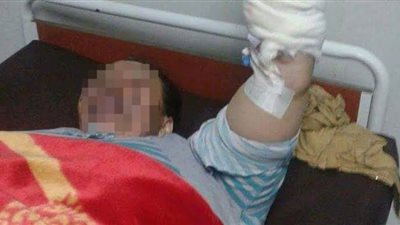 واقعة زلزلت الغربية.. تفاصيل إشعال شاب النيران بوالدته للانتقام