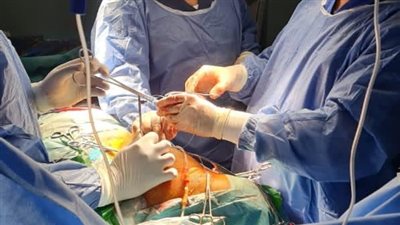 فريق طبي بمستشفى ميت غمر المركزي ينجح في إنقاذ يد مواطن