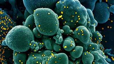 الصحة: التغذية لا تقل أهمية عن تطبيق البروتوكول العلاجي لمرضى كورونا