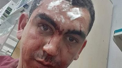 تفاصيل الاعتداء على صيدلي مصري بالسعودية.. ورد وزير القوى العاملة