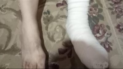 بالصور.. رجولة إبن الغربية تجعله يدفع قدمه ثمنًا للدفاع عن عرض الفتيات