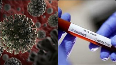 توفير 130 سريرًا للرعاية المركزة بـ