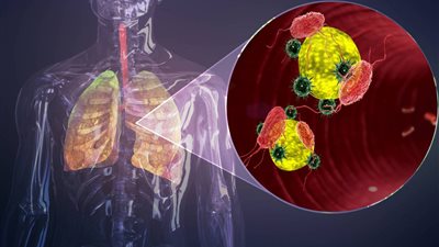 استشاري جهاز هضمي يوضح أعراض فيروس 