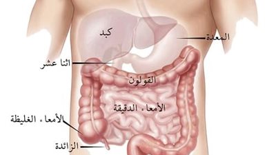 4 أطعمة ينصح مرضى القولون بالابتعاد عنها