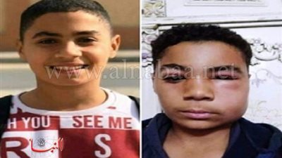 ورم وشه واتريق عليه.. تفاصيل بشعة بشأن اعتداء معلم على تلميذ لأسباب غريبة