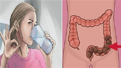 منها الزبادي.. 4 أطعمة ضرورية يحتاجها القولون بصورة مُستمرة