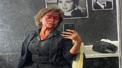 بالصور.. راندا عبد السلام تدخل 