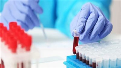 «صحة المنيا»: تحليل 595 ألف عينة بمعامل المستشفيات التابعة للمديرية