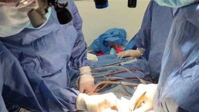تشغيل وحدة جراحات قلب الأطفال بمستشفى ملوى التخصصي في المنيا