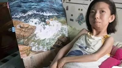 «أنثى فان جوخ» القعيدة تستمر في إلهام العالم رغم انخفاض وزنها 