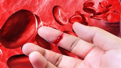 مُعاناة مرض الهيموفيليا.. أسباب وأعراض وعوامل خطورة