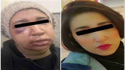 بالتجمع الأول..تفاصيل تعرض سيدة للإعتداء من طليقها بمعاونة 4أشخاص