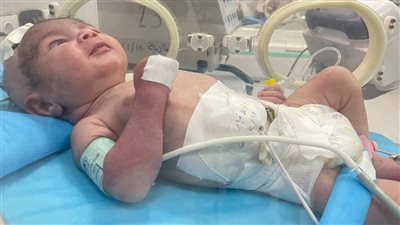 كيف تعاونت الصحة مع التعليم العالي لإنقاذ حياة طفل حديث الولادة؟