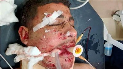 مصرع وإصابة 4 أشخاص في حادث تصادم بشع بالمنيا 